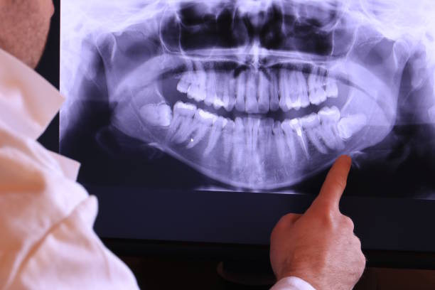 Best Chipped Tooth Repair Near Me  in Dalton, GA